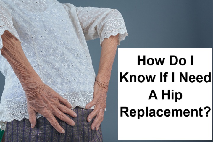 How Do I Know If I Need A Hip Replacement?